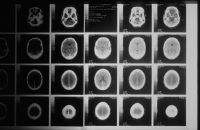 Without memory, who are we? image